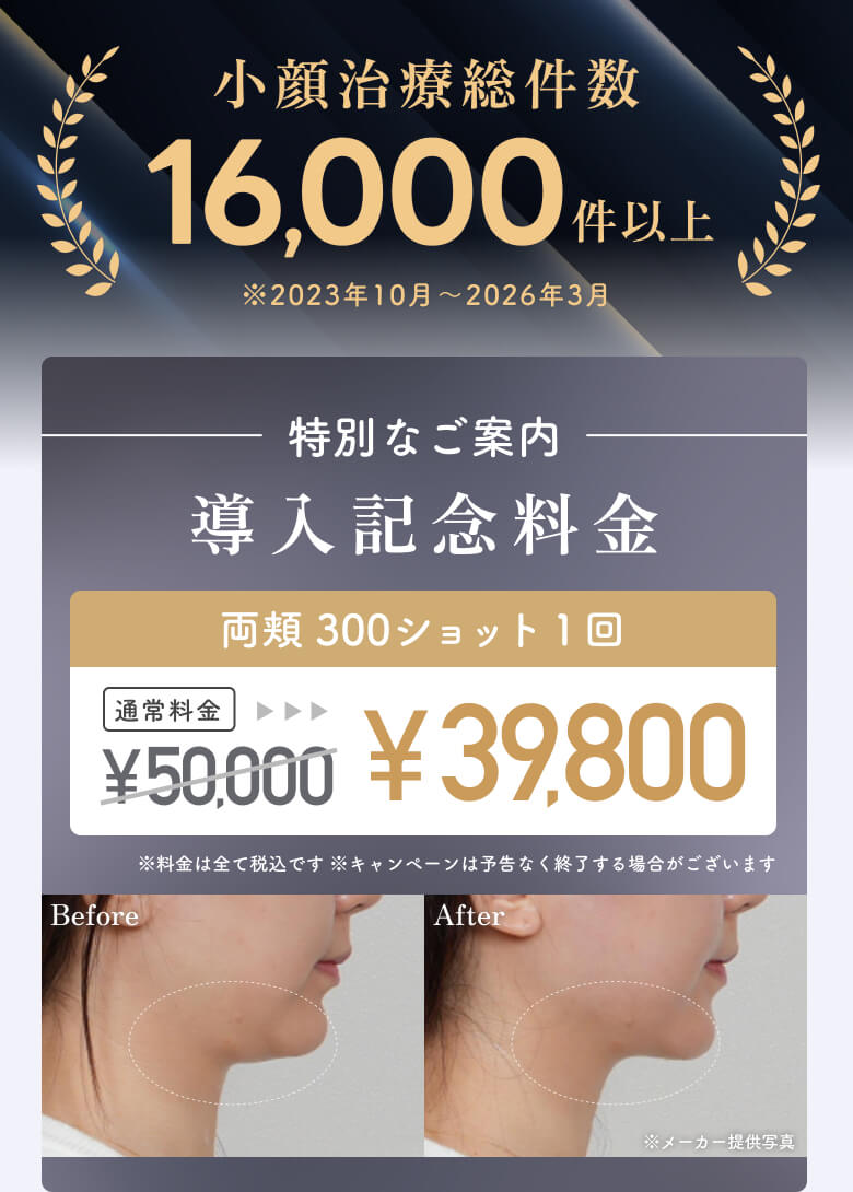 小顔治療総件数16000件以上 導入記念料金