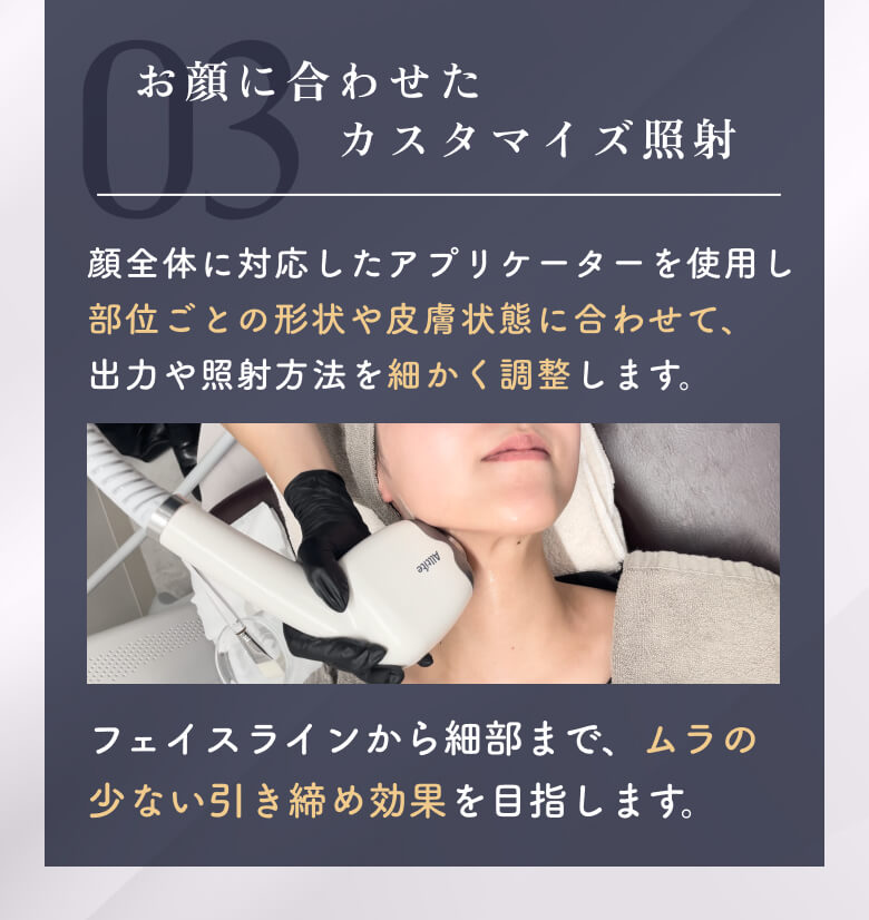 3つのポイント 03