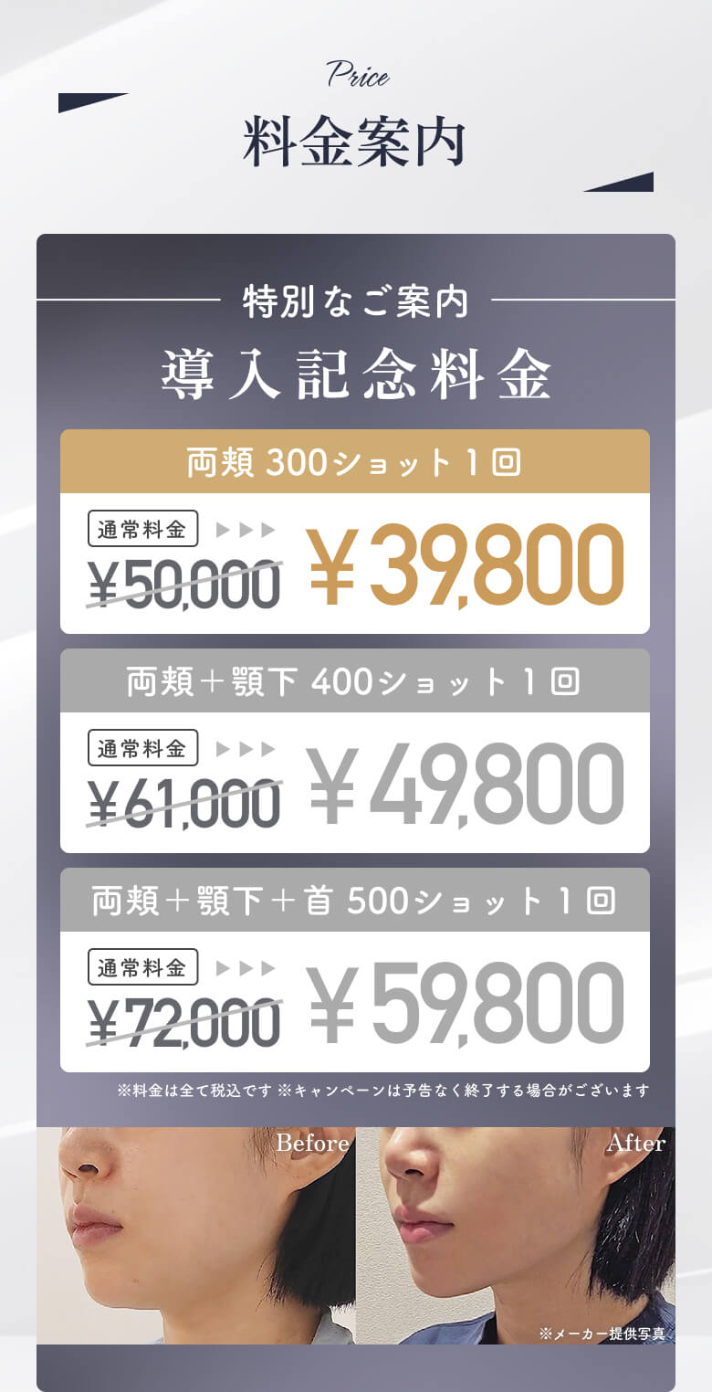 キャンペーン情報