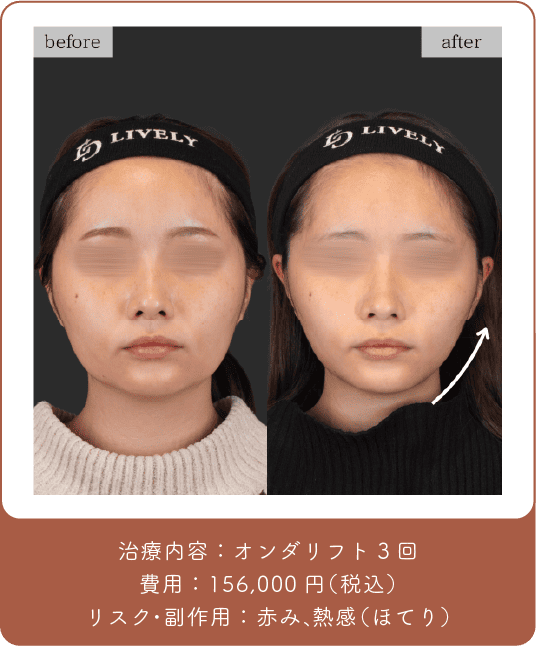 オンダリフト
