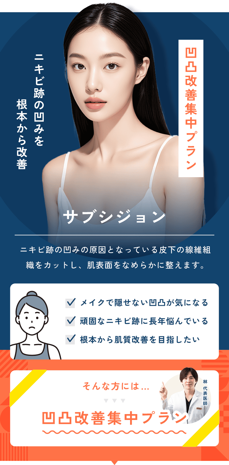 サブシジョン