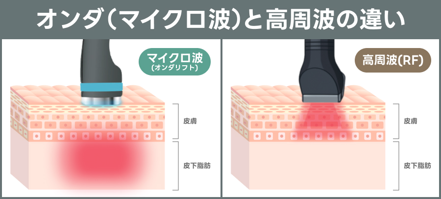 マイクロ波と高周波の違い