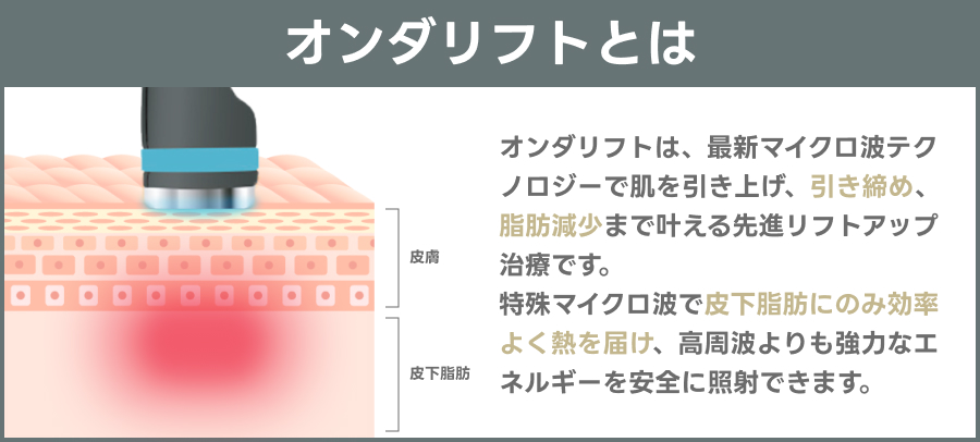 オンダリフトとは