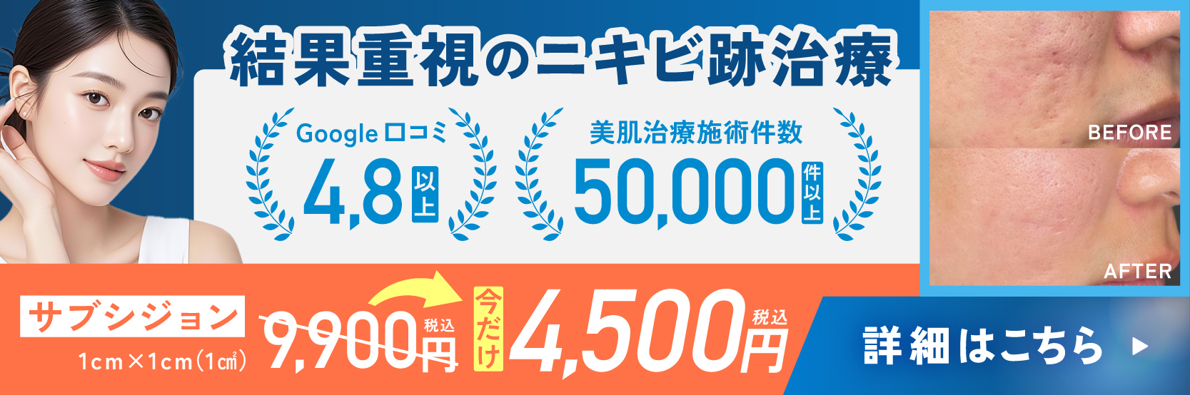 サブシジョン4500円