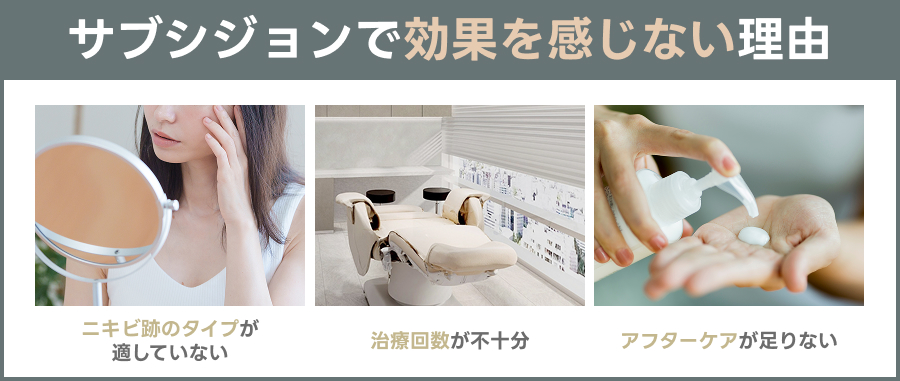 サブシジョンで効果を感じない理由