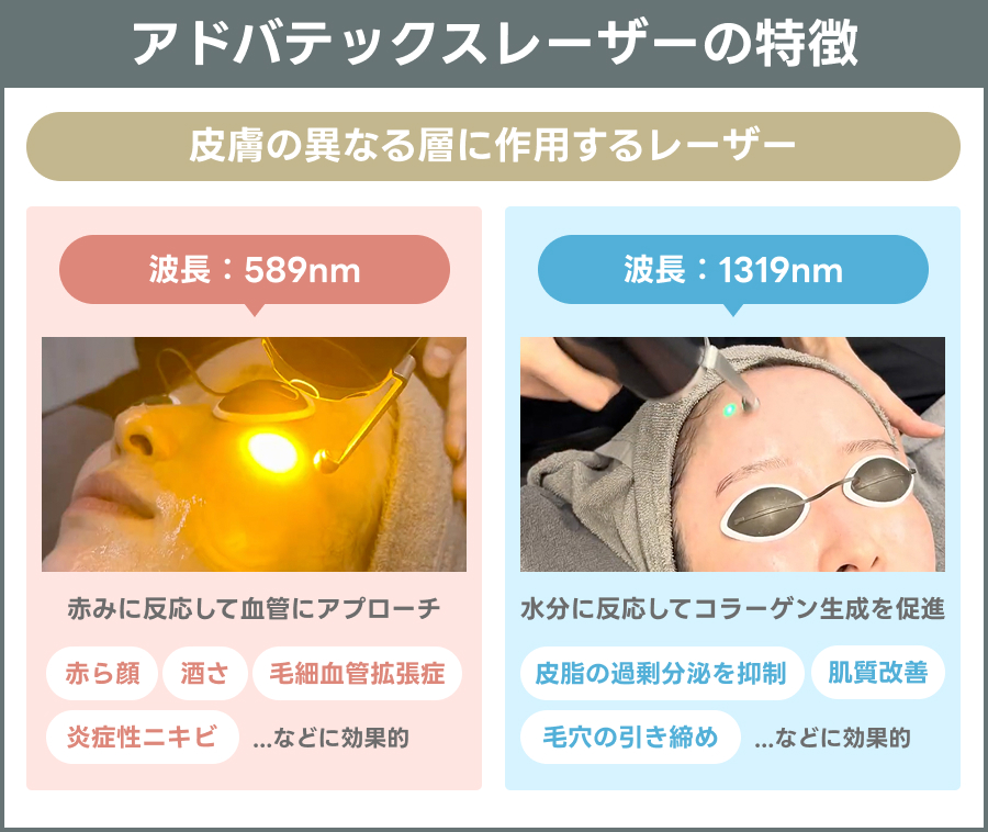 アドバテックスレーザーの仕組みを示す説明図｜ライブリークリニック