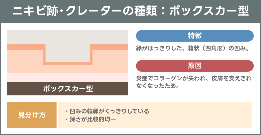 ボックスカー型のニキビ跡・クレーターを示す説明図｜ライブリークリニック