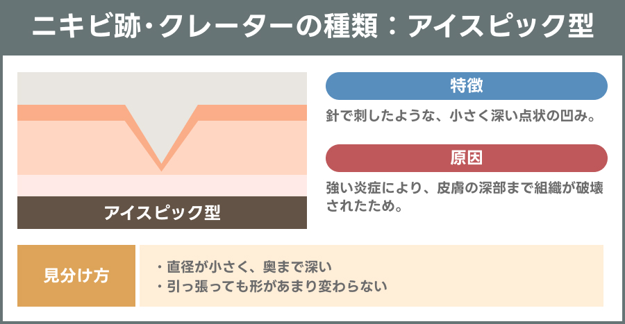 アイスピック型のニキビ跡・クレーターを示す説明図｜ライブリークリニック