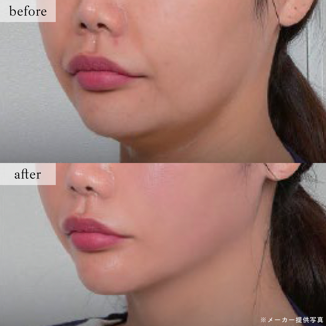 ライブリークリニック｜オールタイトの症例画像