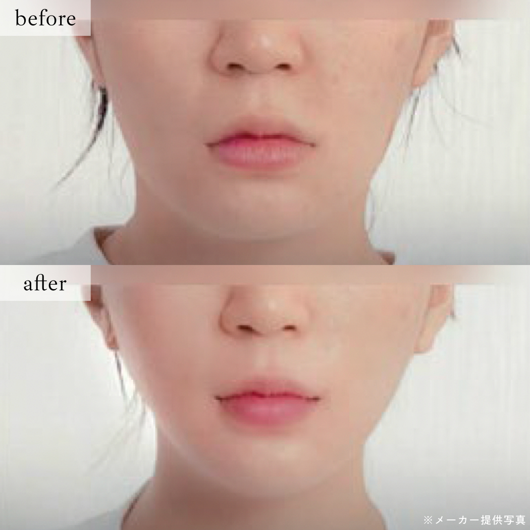 ライブリークリニック｜オールタイトの症例画像