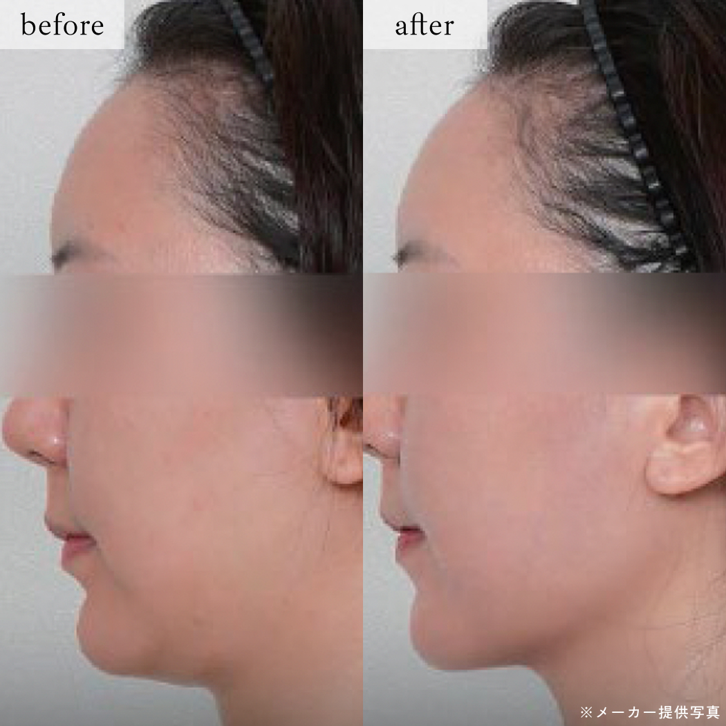 ライブリークリニック｜オールタイトの症例画像