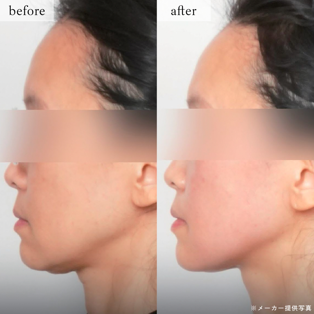 ライブリークリニック｜オールタイトの症例画像