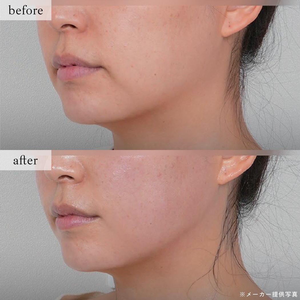 ライブリークリニック｜オールタイトの症例画像