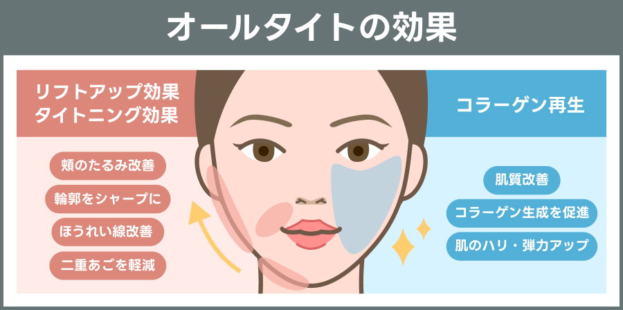 オールタイトの効果を図解で説明｜ライブリークリニック