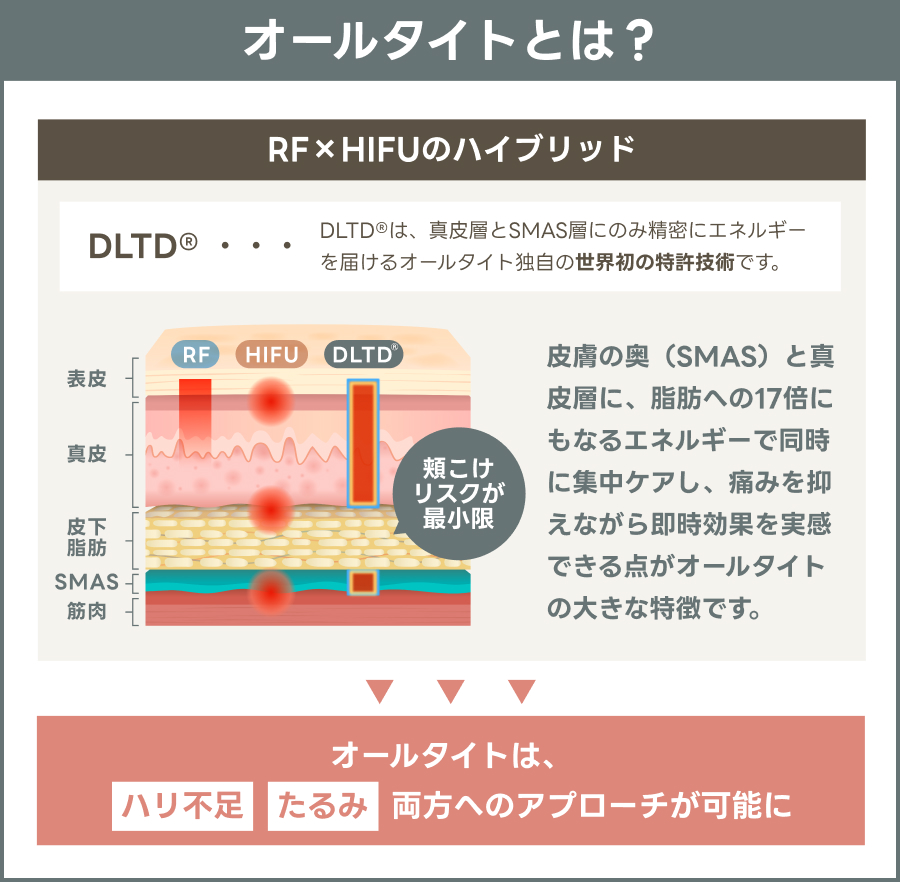 オールタイトについて図解で解説｜ライブリークリニック