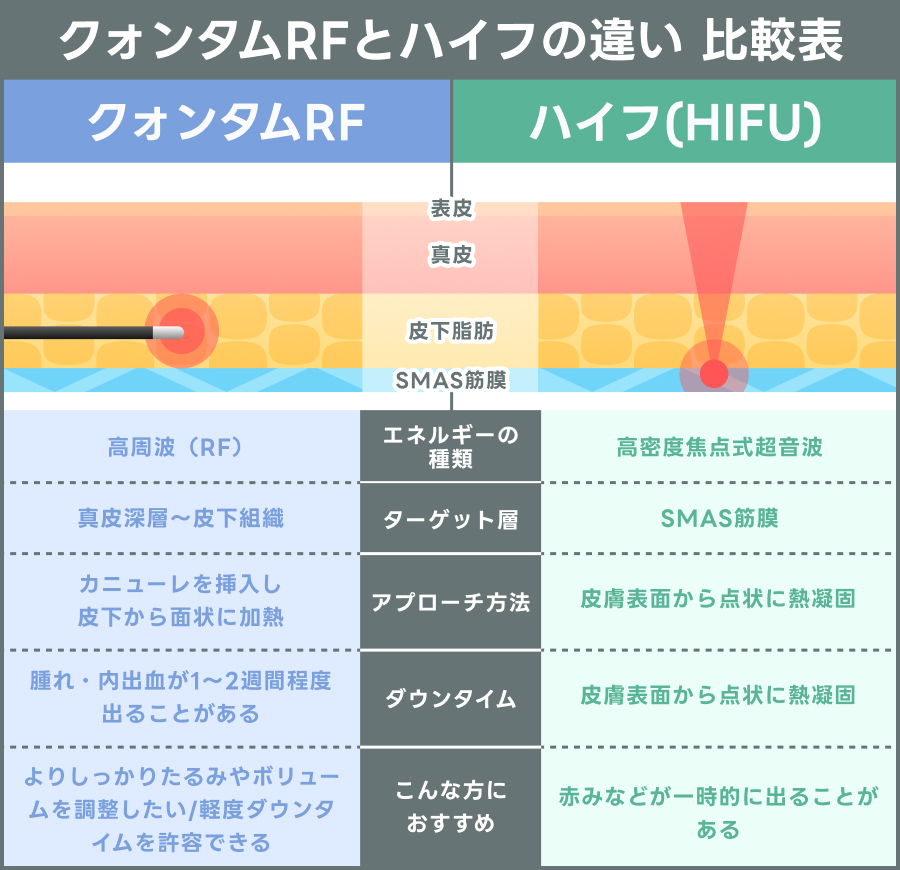 クォンタムRFとハイフ（HIFU）の違いを表す比較表｜ライブリークリニック