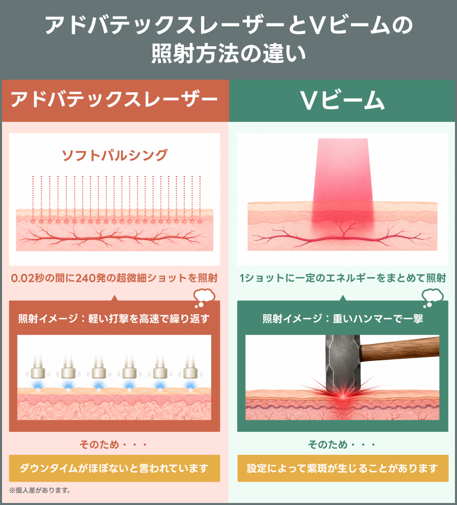 アドバテックスレーザーとVビームの照射方法の違い｜ライブリークリニック