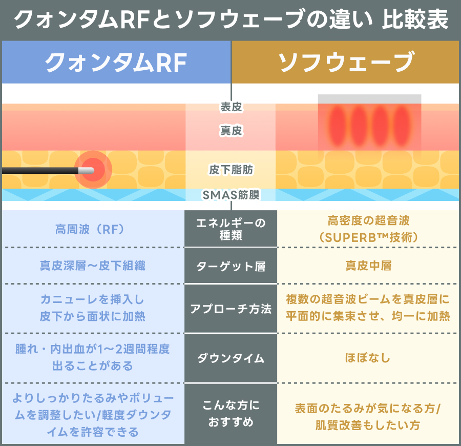 クォンタムRFとソフウェーブの違いを表す比較表｜ライブリークリニック