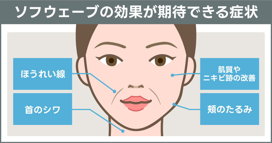 ソフウェーブの効果が期待できる症状を解説｜ライブリークリニック