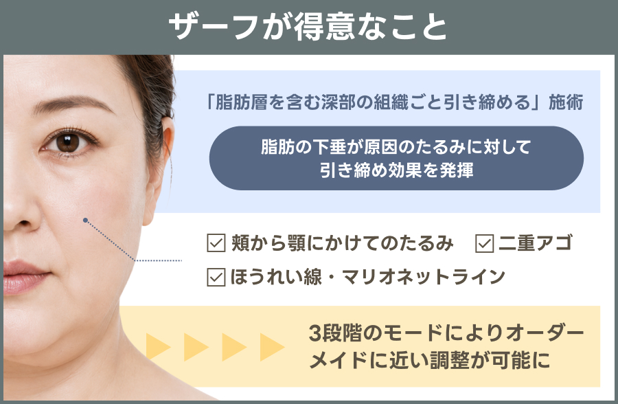 ザーフが得意なことの解説図｜ライブリークリニック