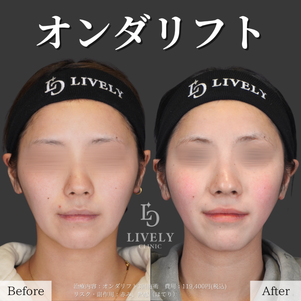 保護中: test