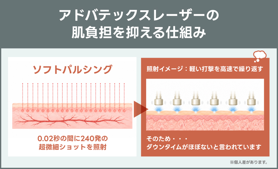 アドバテックスレーザーの肌の負担を抑える仕組み｜ライブリークリニック