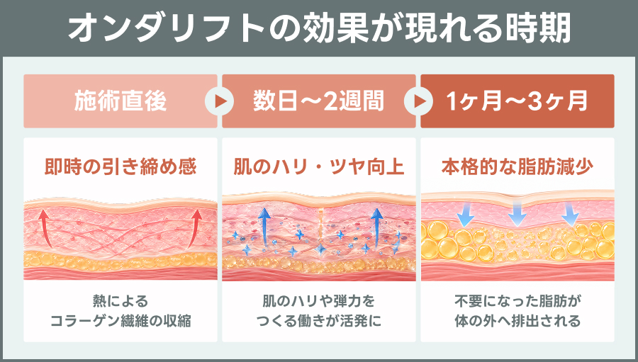 オンダリフトの効果が現れる時期｜ライブリークリニック