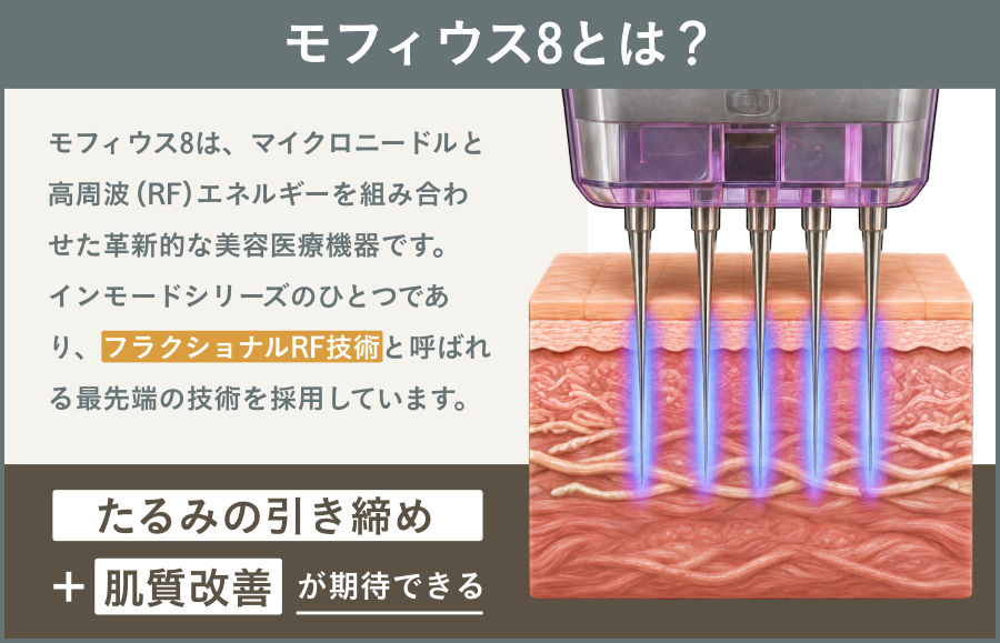 モフィウス8とはどのような施術なのか、特徴や仕組み、目の下のクマ改善へのアプローチをわかりやすく解説｜ライブリークリニック