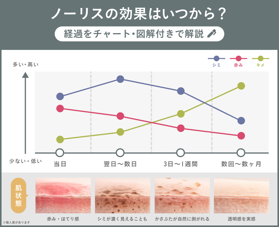 ノーリスの効果はいつから？経過をチャート・図解付きで解説｜ライブリークリニック
