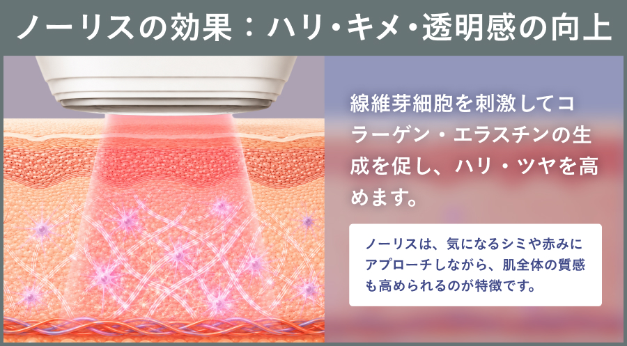 ノーリスの効果：ハリ・キメ・透明感改善｜ライブリークリニック