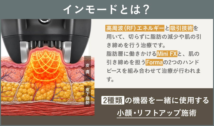 インモードとはを解説する説明図｜ライブリークリニック